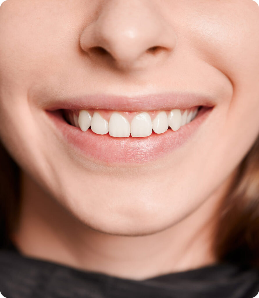 Cosmetic Dentistry in Oman