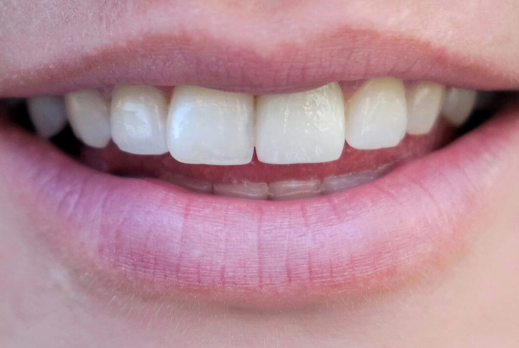 After profile dental treatment in muscat oman