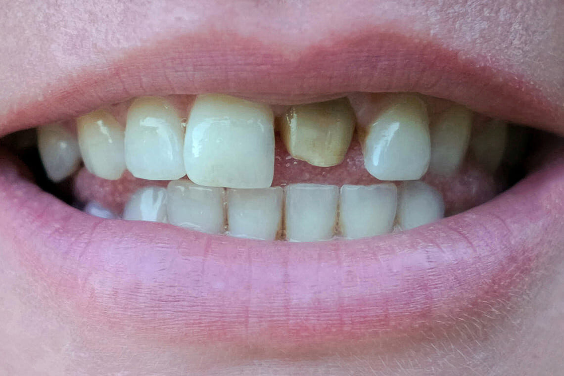 before profile dental treatment in muscat oman