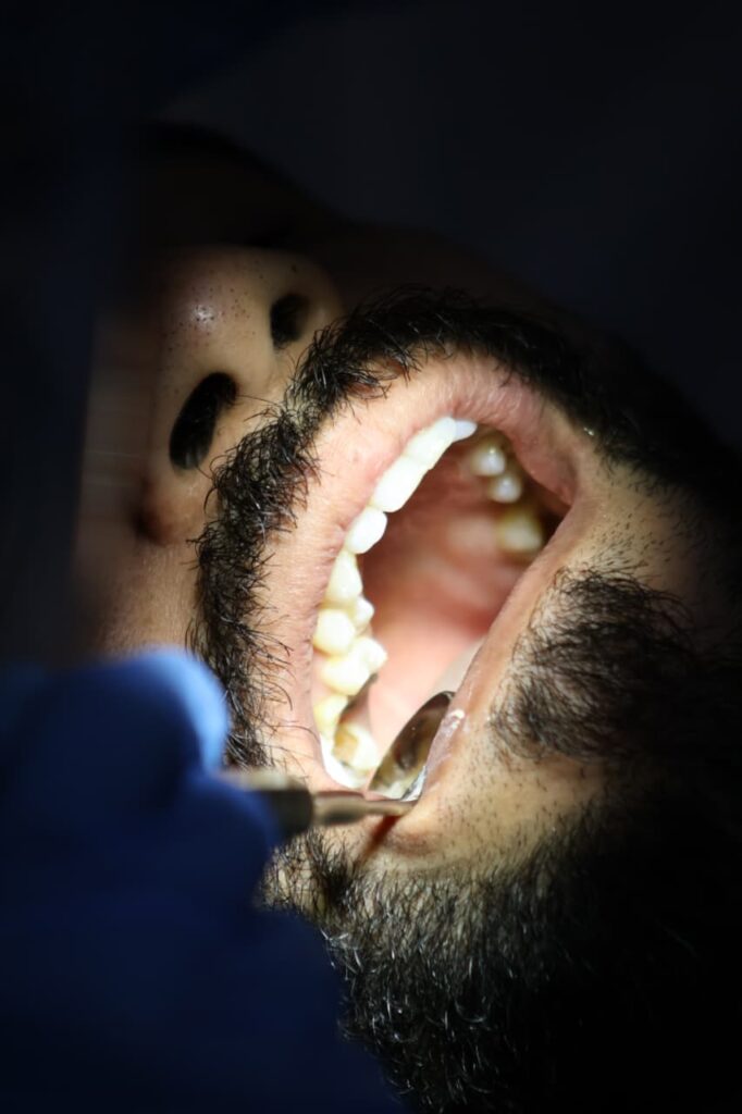 Dental implants in Muscat
