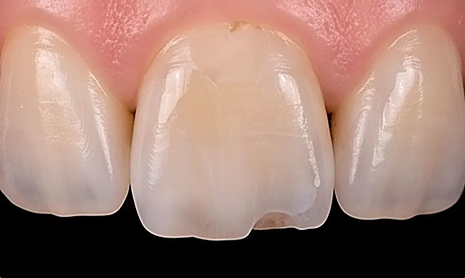 Cosmetic Corrections in Oman